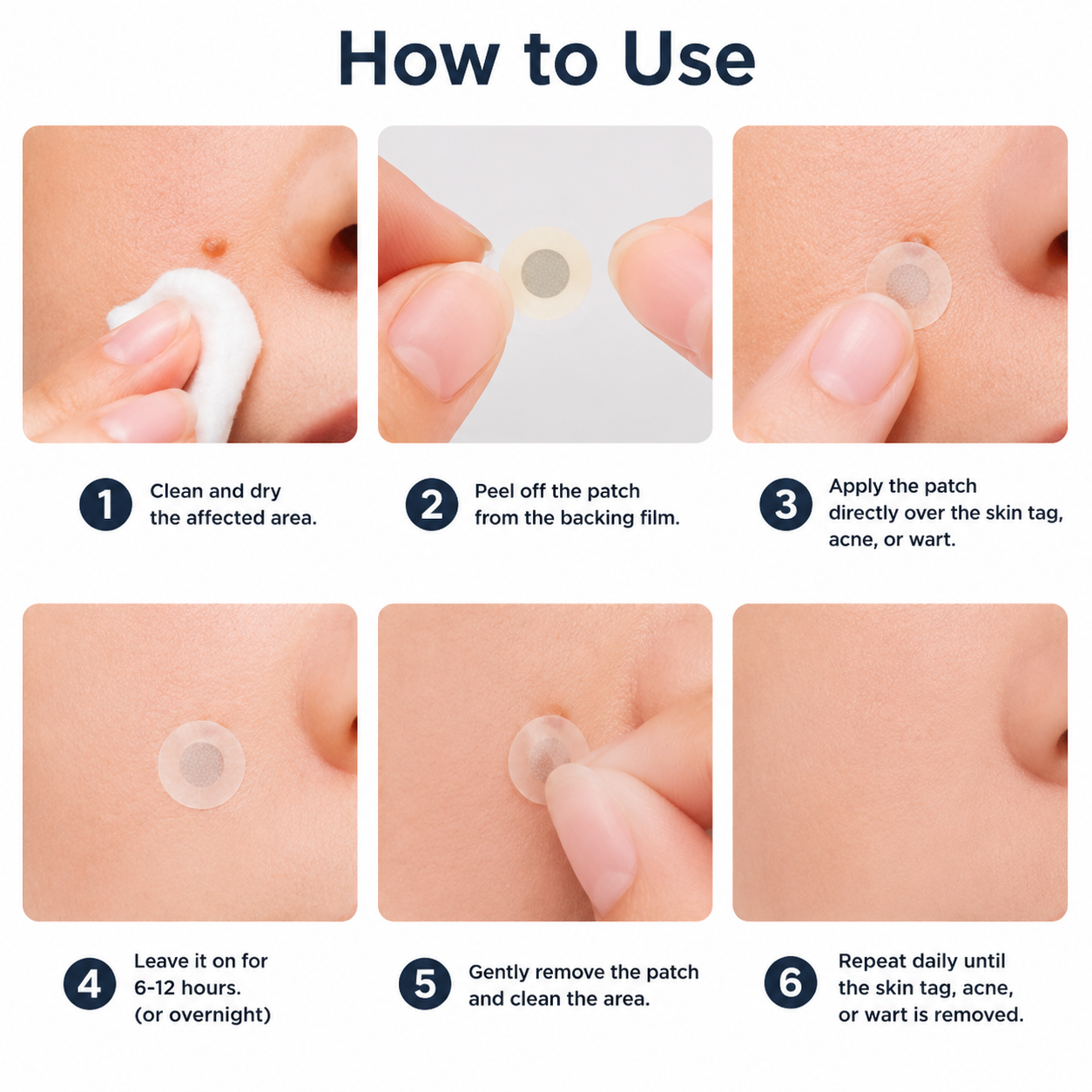 🔥Ends Today: 70% OFF!✨KLENIMORE™2-in-1 Microneedle & Hydrocolloid Patch🍀