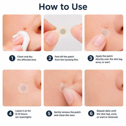 🔥Ends Today: 70% OFF!✨KLENIMORE™2-in-1 Microneedle & Hydrocolloid Patch🍀