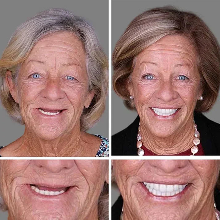 ⏰Ends Today: 50% OFF!  🏆2026 Bestselling Product🦷 Fit for a Fresh Smile, Say Goodbye to Wearing Discomfort!🌎