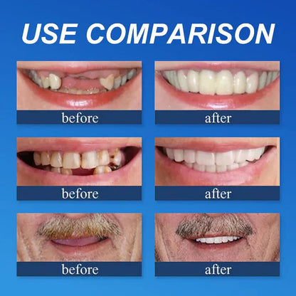⏰Ends Today: 50% OFF!  🏆2026 Bestselling Product🦷 Fit for a Fresh Smile, Say Goodbye to Wearing Discomfort!🌎
